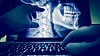 Blant annet røntgensystemer hos helseforetak i en rekke land er truffet av målrettede dataangrep, som også har rammet Norge, ifølge den ferske rapporten fra Symantec.