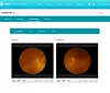 Optikere kan sende bilder av klienten – som forblir anonym – sin netthinne direkte til øyelegene hos Eyecheck System for vurdering. Foto: Eyecheck System