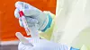 Norges politikk med å gjennomføre relativt få tester for koronavirus har møtt kritikk blant helsepersonell i de siste dagene.